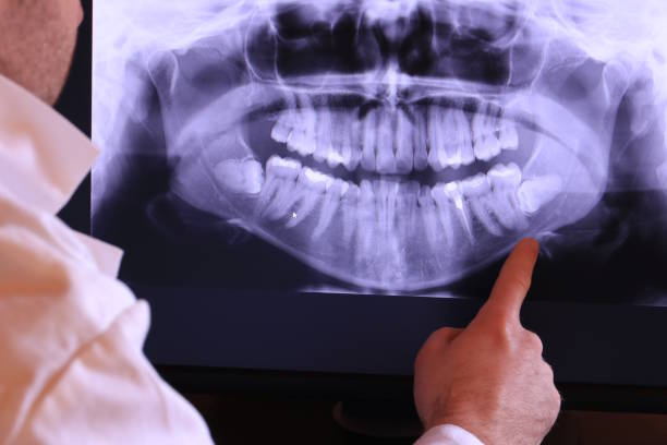 Best Emergency Root Canal Therapy in Greenwood Lake, NY