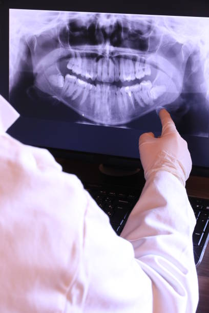 Best Emergency Denture Repair in Greenwood Lake, NY