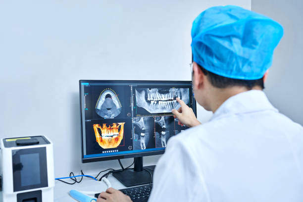 Best Emergency Wisdom Tooth Extraction in Greenwood Lake, NY